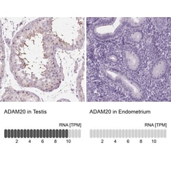 ADAM20 Antibody, Novus Biologicals:Antibodies:Primary Antibodies